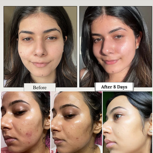 Dr. Althea 345 Relief Cream