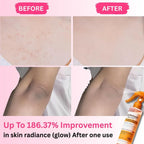 Dr. Melaxin Peel Shot – Kojic Acid Body Spray