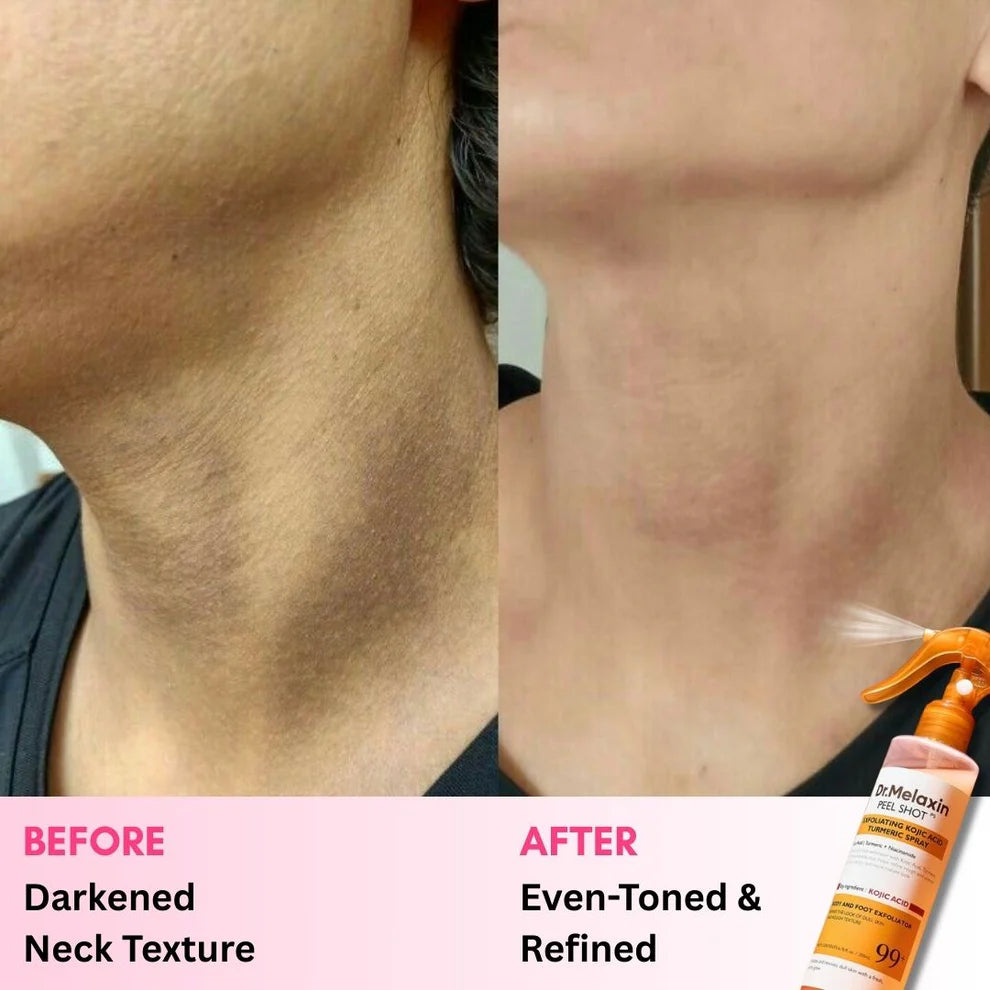 Dr. Melaxin Peel Shot – Kojic Acid Body Spray