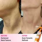 Dr. Melaxin Peel Shot – Kojic Acid Body Spray