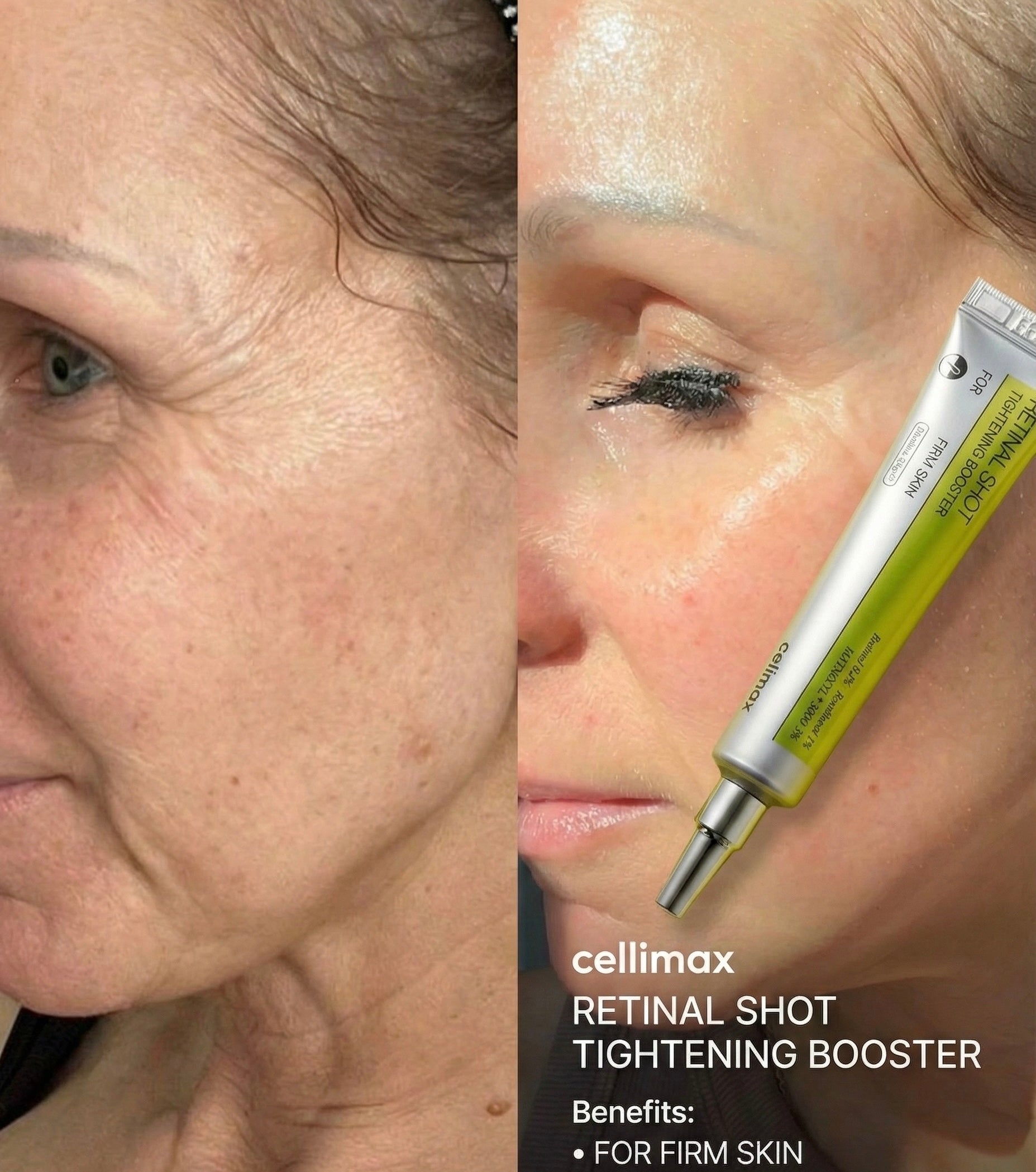 Celimax The Vita-A Retinal Shot Tightening Booster