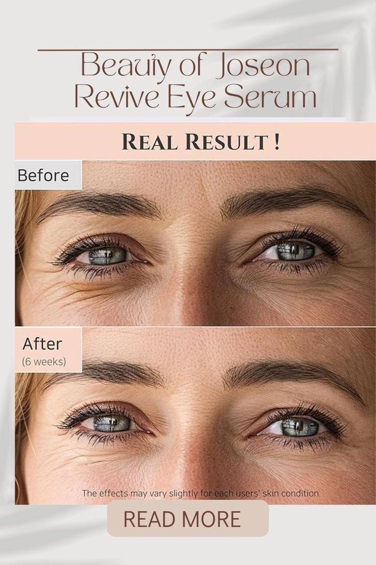 Beauty of Joseon Revive Eye Serum — Ginseng & Retinal | Youthful Glow for Tired Eyes