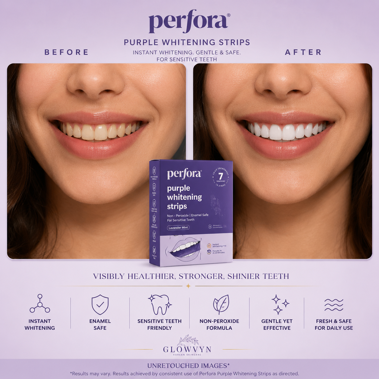 Perfora purple teeth whitening strips