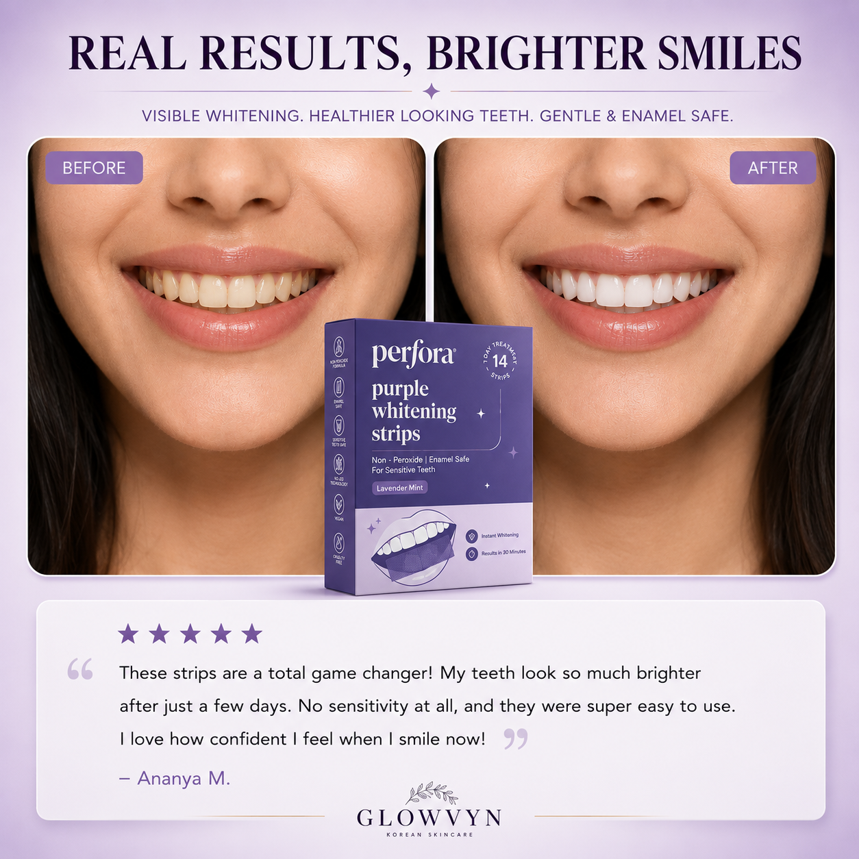 Perfora purple teeth whitening strips